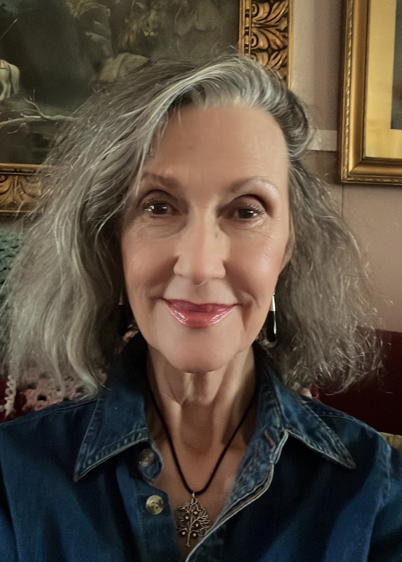 Hyperacusis After MRI Scan – Kathy McCain’s Testimony