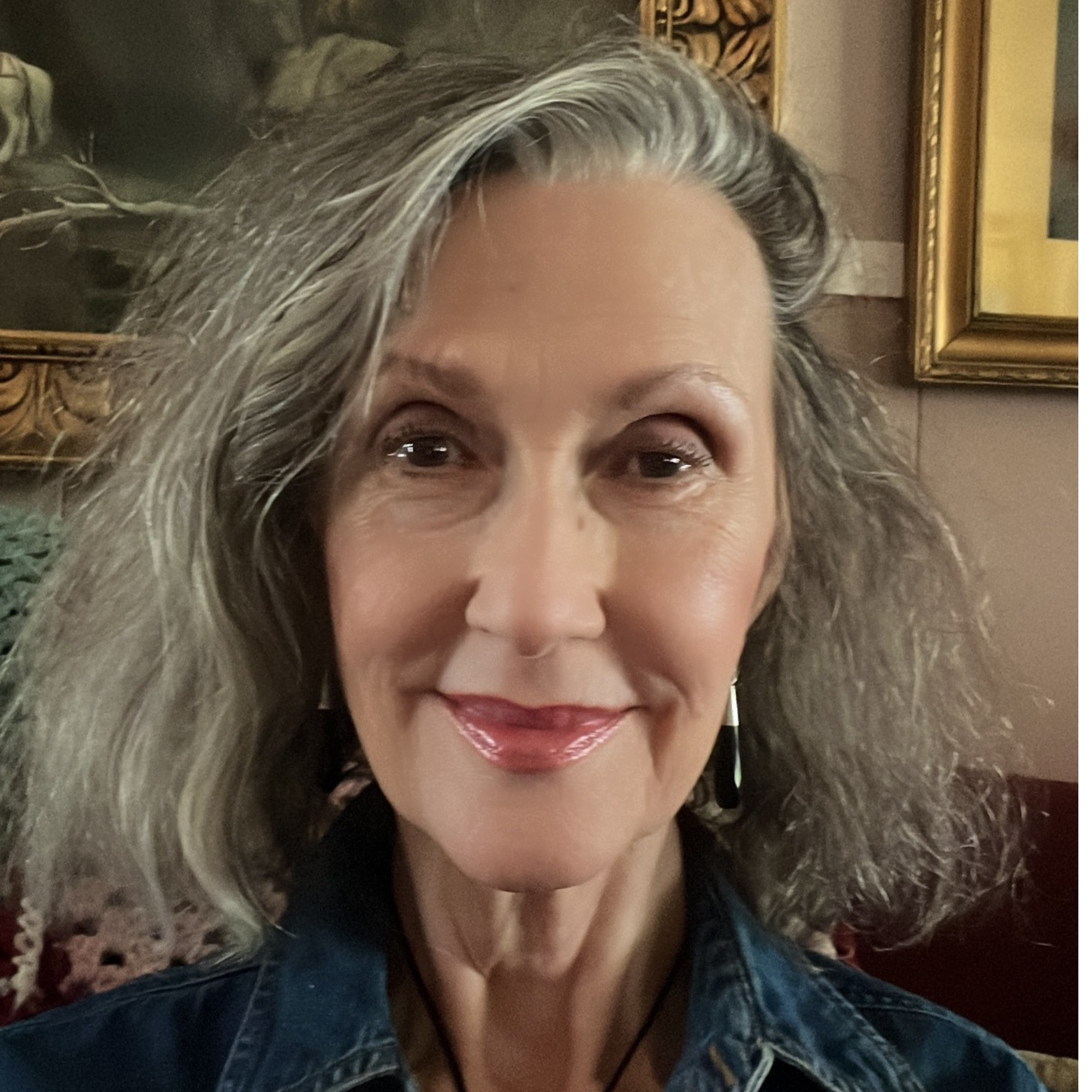 Hiperacusia tras Resonancia Magnética