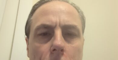 Hyperacusis Musician Drums